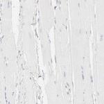 ITGA5 Antibody in Immunohistochemistry (Paraffin) (IHC (P))