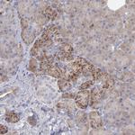 MDA5 Antibody in Immunohistochemistry (Paraffin) (IHC (P))