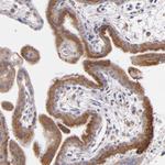 MDA5 Antibody in Immunohistochemistry (Paraffin) (IHC (P))