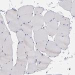 MDA5 Antibody in Immunohistochemistry (Paraffin) (IHC (P))