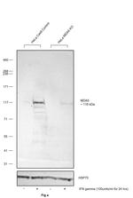 MDA5 Antibody in Western Blot (WB)