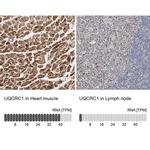 UQCRC1 Antibody