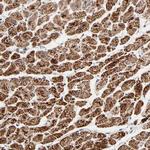 UQCRC1 Antibody in Immunohistochemistry (Paraffin) (IHC (P))