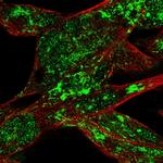 RSK4 Antibody in Immunocytochemistry (ICC/IF)