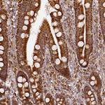 SDHB Antibody in Immunohistochemistry (Paraffin) (IHC (P))