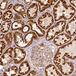 SDHB Antibody in Immunohistochemistry (Paraffin) (IHC (P))