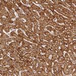 SDHB Antibody in Immunohistochemistry (Paraffin) (IHC (P))