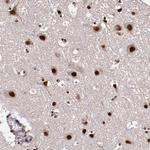 CECR2 Antibody in Immunohistochemistry (Paraffin) (IHC (P))