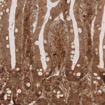 NG2 Antibody in Immunohistochemistry (Paraffin) (IHC (P))