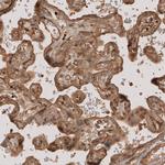 NG2 Antibody in Immunohistochemistry (Paraffin) (IHC (P))