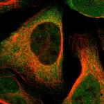 NCAPH Antibody in Immunocytochemistry (ICC/IF)