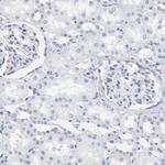 NCAPH Antibody in Immunohistochemistry (Paraffin) (IHC (P))