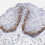 NCAPH Antibody in Immunohistochemistry (Paraffin) (IHC (P))