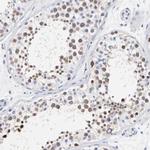 NCAPH Antibody in Immunohistochemistry (Paraffin) (IHC (P))