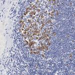 NCAPH Antibody in Immunohistochemistry (Paraffin) (IHC (P))