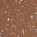 GNAZ Antibody in Immunohistochemistry (Paraffin) (IHC (P))