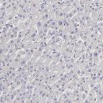 GNAZ Antibody in Immunohistochemistry (Paraffin) (IHC (P))