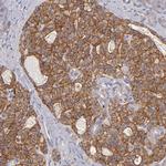 GNAZ Antibody in Immunohistochemistry (Paraffin) (IHC (P))