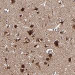 BNIP3 Antibody in Immunohistochemistry (Paraffin) (IHC (P))