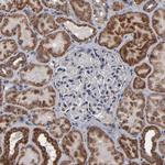 BNIP3 Antibody in Immunohistochemistry (Paraffin) (IHC (P))