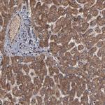 BNIP3 Antibody in Immunohistochemistry (Paraffin) (IHC (P))