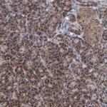 BNIP3 Antibody in Immunohistochemistry (Paraffin) (IHC (P))