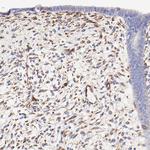 SPARC Antibody in Immunohistochemistry (Paraffin) (IHC (P))