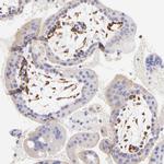 SPARC Antibody in Immunohistochemistry (Paraffin) (IHC (P))