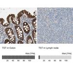 TST Antibody