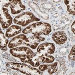 TST Antibody in Immunohistochemistry (Paraffin) (IHC (P))