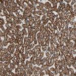 TST Antibody in Immunohistochemistry (Paraffin) (IHC (P))