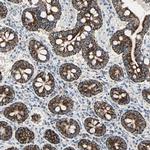 TST Antibody in Immunohistochemistry (Paraffin) (IHC (P))