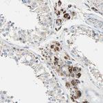 TST Antibody in Immunohistochemistry (Paraffin) (IHC (P))