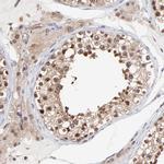 PSMA6 Antibody in Immunohistochemistry (Paraffin) (IHC (P))