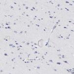 Zap-70 Antibody in Immunohistochemistry (Paraffin) (IHC (P))