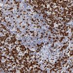 Zap-70 Antibody in Immunohistochemistry (Paraffin) (IHC (P))