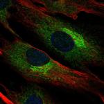 Biglycan Antibody in Immunocytochemistry (ICC/IF)