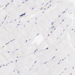 Biglycan Antibody in Immunohistochemistry (Paraffin) (IHC (P))