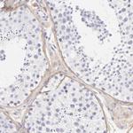 Biglycan Antibody in Immunohistochemistry (Paraffin) (IHC (P))