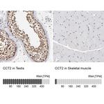 TCP-1 beta Antibody