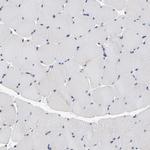 TCP-1 beta Antibody in Immunohistochemistry (Paraffin) (IHC (P))