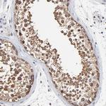 TCP-1 beta Antibody in Immunohistochemistry (Paraffin) (IHC (P))