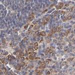 TCP-1 beta Antibody in Immunohistochemistry (Paraffin) (IHC (P))