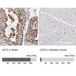 TCP-1 beta Antibody