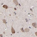 TCP-1 beta Antibody in Immunohistochemistry (Paraffin) (IHC (P))