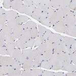 TCP-1 beta Antibody in Immunohistochemistry (Paraffin) (IHC (P))