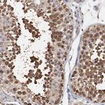 TCP-1 beta Antibody in Immunohistochemistry (Paraffin) (IHC (P))