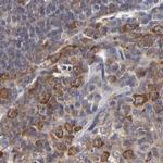 TCP-1 beta Antibody in Immunohistochemistry (Paraffin) (IHC (P))