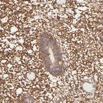 PTK7 Antibody in Immunohistochemistry (Paraffin) (IHC (P))