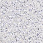 PTK7 Antibody in Immunohistochemistry (Paraffin) (IHC (P))